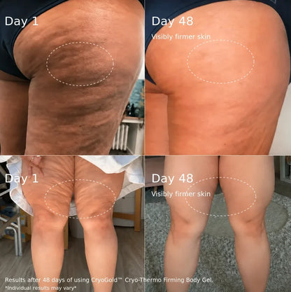 Cryo thermacal cream